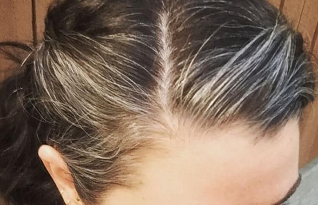 تجربتي مع الشيب المبكر يمكنك معرفة كل