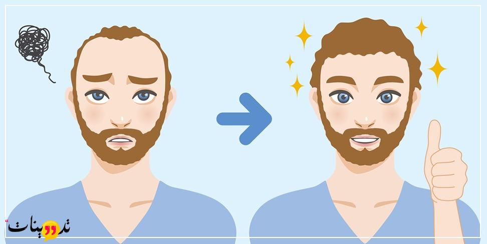 زراعة الشعر في جدة بكم حيث التعرف على متوسط تكلفة تلك العملية والتعرف على المراكز الهامة