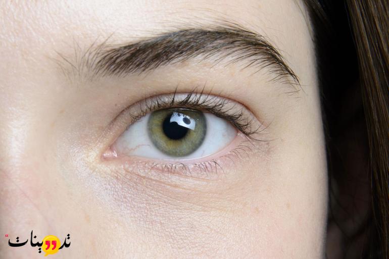 تجربتي في التخلص من تجاعيد العين تعرف