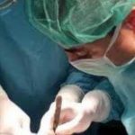 تجارب الناس مع البواسير
