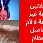 كيفية استخدام الجيلاتين لعلاج المفاصل