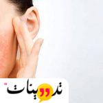 تجربتي مع علاج حساسية الوجه